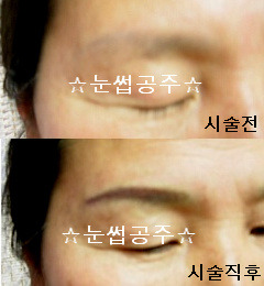눈썹공주 이미지
